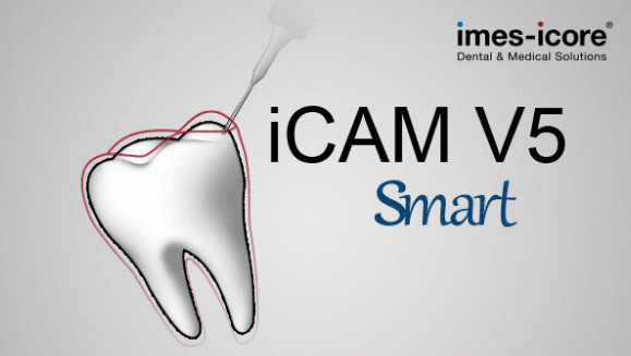 iCAM V5 smart 加密狗版 义齿切削排版软件 牙科软件 millbox Imes iCAM V5 Smart